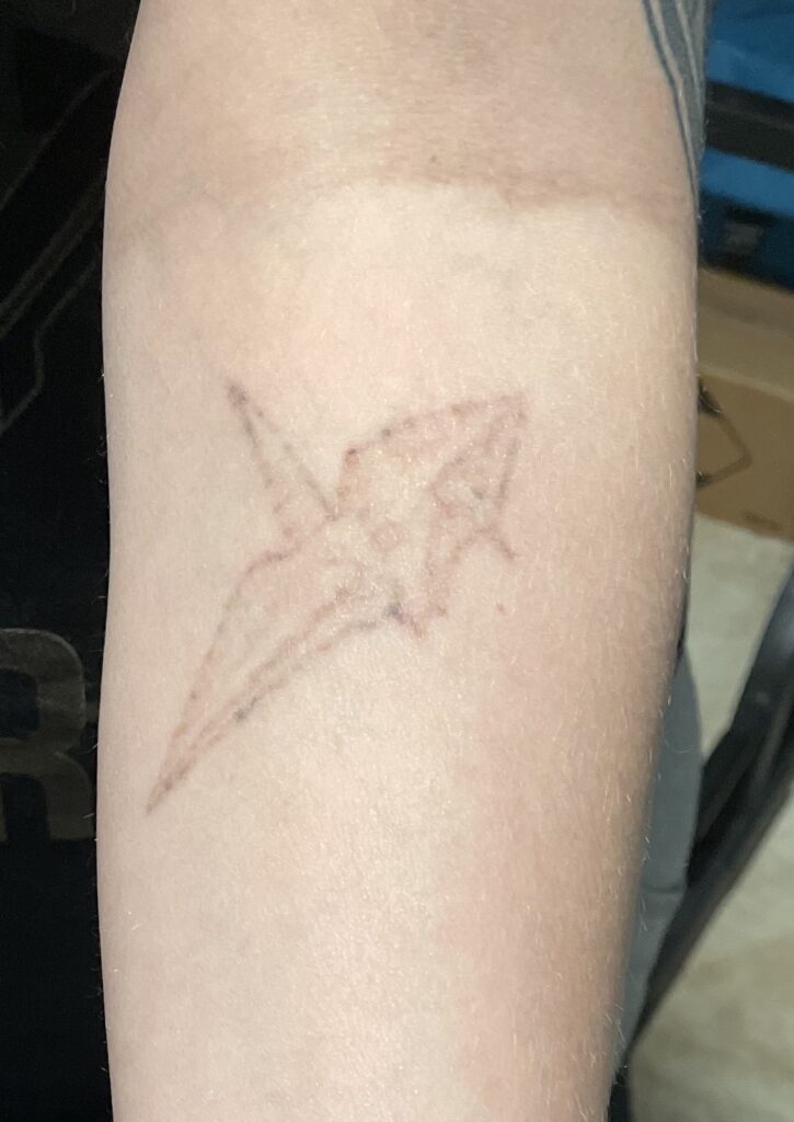 After 2 tattoo removal sessions this tattoo is almost completely gone