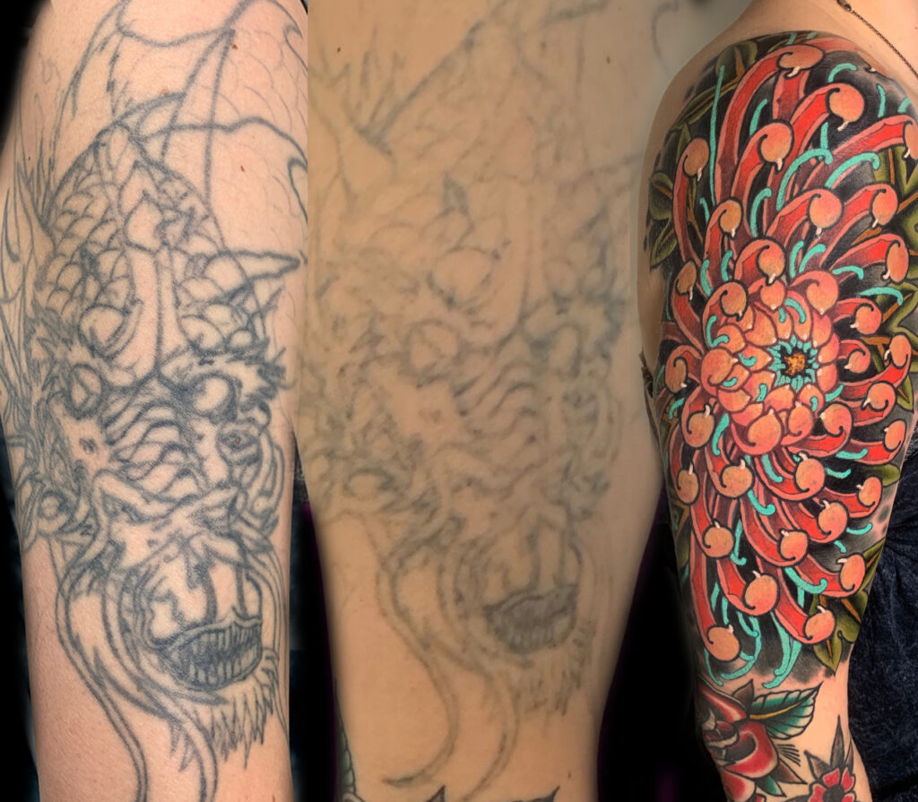 Gain awesome new ink with a tattoo cover up | Tattoo Removal