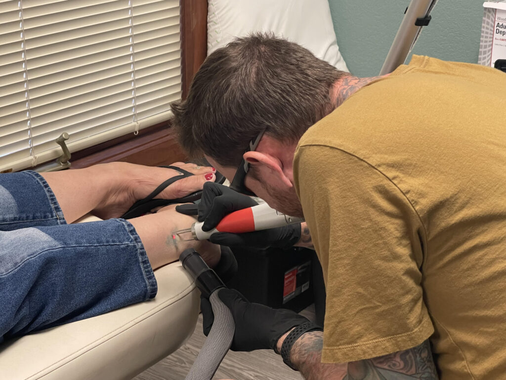 does tattoo removal hurt?